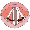 Vocal+Folds Picture