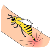 Bee Sting Picture