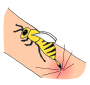 Bee Sting  Picture