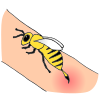 Bee Sting