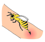 Bee Sting  Picture