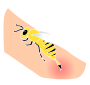 Bee Sting Stencil