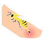 Bee Sting  Stencil