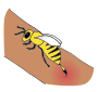 Bee Sting  Picture