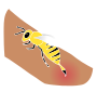 Bee Sting  Stencil