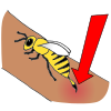 Bee Sting