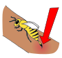 Bee Sting  Picture