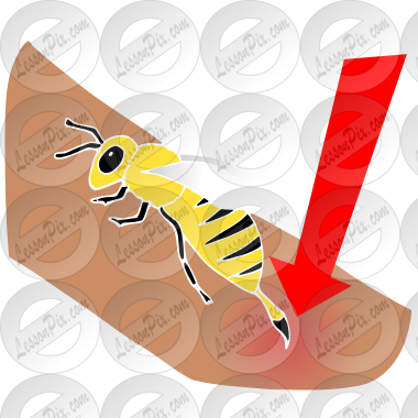 Bee Sting