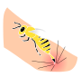 Bee Sting