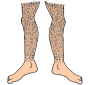 Hairy Legs