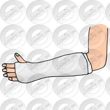 Cast