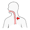 Esophagus Picture