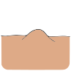 Lump
