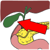 Gall Bladder