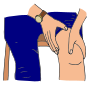 Sore Knee