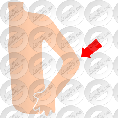 Arm