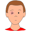 Pink Eye