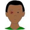 Pink Eye