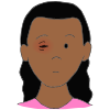 Pink Eye