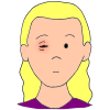 Pink Eye