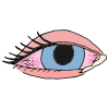 Pink Eye