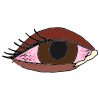 Pink Eye