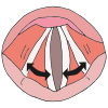 Vocal Folds Picture