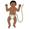 Feeding Tube  Picture