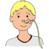 Feeding Tube  Picture