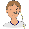 Feeding Tube  Picture