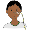 Feeding Tube  Picture