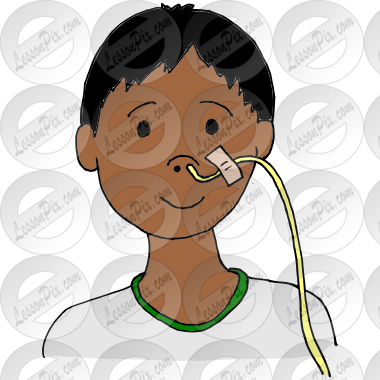 Feeding Tube