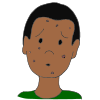 Acne  Picture