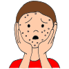 Pimples  Picture