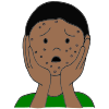Pimples  Picture
