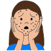 Pimples  Picture