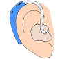 Hearing Aid Picture
