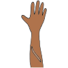 Scar