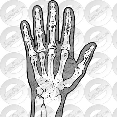 Xray