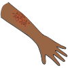 Rash