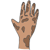 Dirty Hand