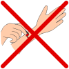 Do Not Pick Scab  Picture