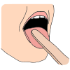 Tongue Depressor  Picture