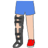 Leg Brace Picture