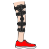 Leg Brace Picture