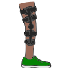 Leg Brace Picture