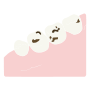 Cavities