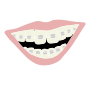 Braces Stencil