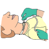 Suction  Picture