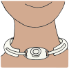Trach  Picture